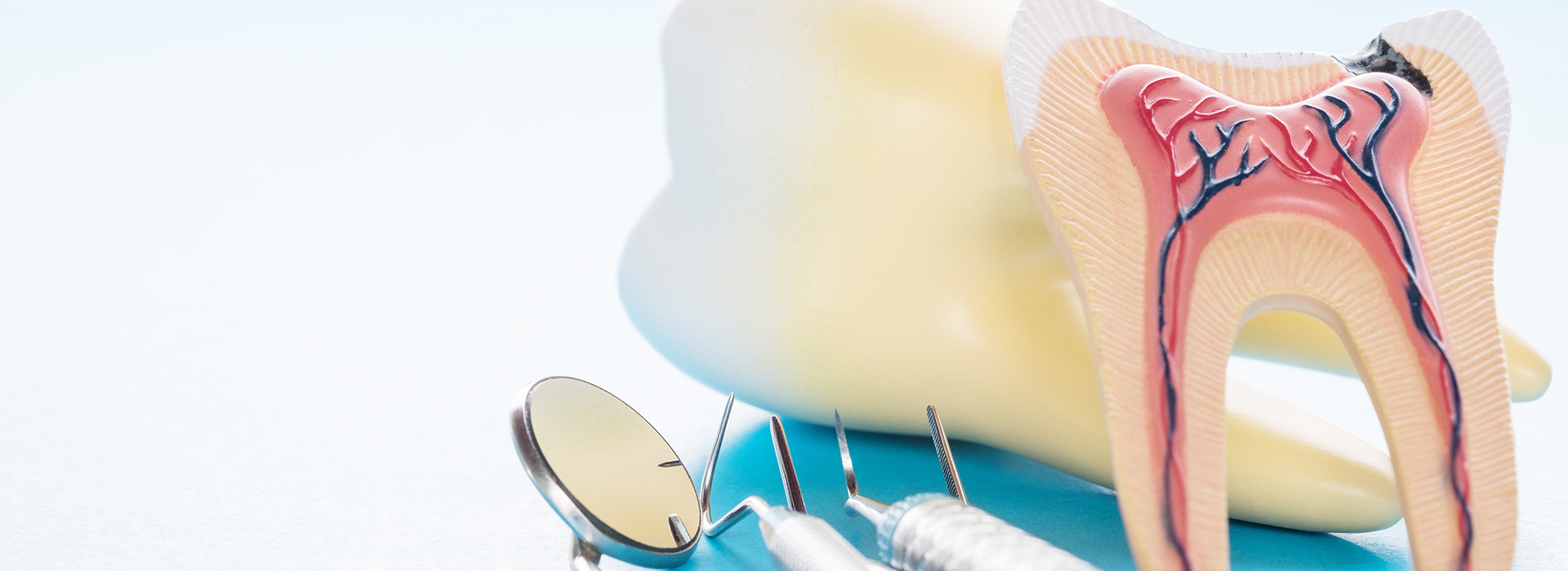 Crossroads Dental Group | Crowns  amp  Caps, Dental Fillings and Invisalign reg 